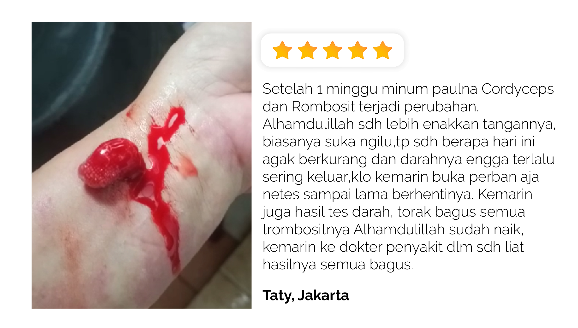 Cordyceps terbaik